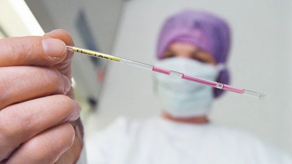Medizinische Fachperson hält im Kinderwunschzentrum Bern eine dünne Laborpipette mit rosa Markierungen.